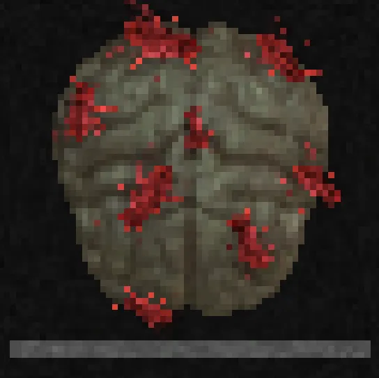 bad flesh. screenshot: a pixelated grey brain clotted with red patches above a progress bar